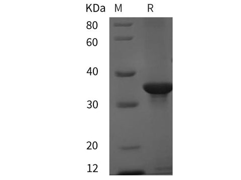 SDS-PAGE analysis of Mouse cyclin D3/CCND3 proteins, 2 μg/lane of Recombinant Mouse cyclin D3/CCND3 proteins was resolved with SDS-PAGE under reducing conditions, showing bands at 35 kDa.