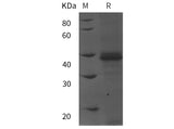 SDS-PAGE analysis of Human PP2A-Cα/PPP2CA proteins, 2 μg/lane of Recombinant Human PP2A-Cα/PPP2CA proteins was resolved with SDS-PAGE under reducing conditions, showing bands at 40 kDa.