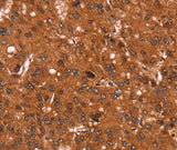 Anti-Human/Mouse/Rat Cyclin D3 Antibody - ABMIUM