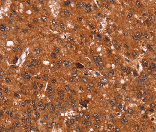 Anti-Human/Mouse/Rat Cyclin D3 Antibody - ABMIUM
