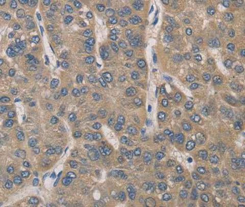 Anti-Human/Mouse IRAK4 Antibody