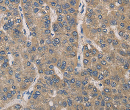 Anti-Human/Mouse IRAK4 Antibody - ABMIUM