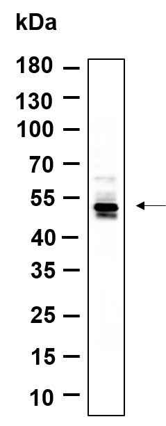 Anti-Human/Mouse/Rat CaMKII α, β Antibody [B902] - ABMIUM