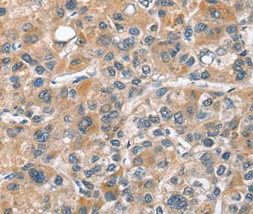 Anti-Human/Mouse CHMP4B Antibody