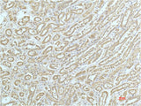 Immunohistochemistry of paraffin-embedded Human kidney tissue using ACTN1 Monoclonal Antibody at dilution of 1:200.