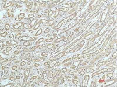 Anti-Human/Mouse/Rat ACTN1 Antibody [1D4]