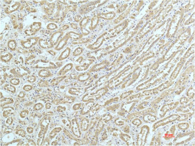 Immunohistochemistry of paraffin-embedded Human kidney tissue using ACTN1 Monoclonal Antibody at dilution of 1:200.