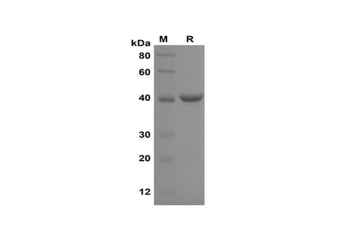 SDS-PAGE analysis of Rat IL-2 proteins,2 μg/lane of Recombinant Rat IL-2 proteins,was resolved with SDS-PAGE under reducing conditions,showing bands at 40 kDa.