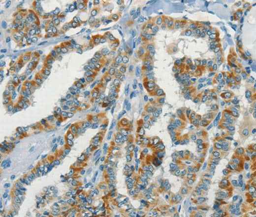 Anti-Human NPAP1 Antibody