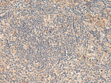 Immunohistochemistry of paraffin-embedded Human tonsil tissue using FUNDC2 Polyclonal Antibody at dilution of 1:50(×200)