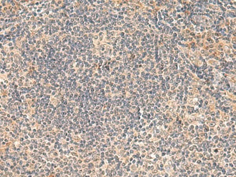 Immunohistochemistry of paraffin-embedded Human tonsil tissue using FUNDC2 Polyclonal Antibody at dilution of 1:50(×200)