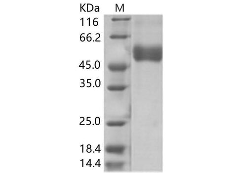Recombinant WNV (lineage 1, strain NY99) NS1 Protein (His Tag) - ABMIUM