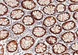 Anti-Human TXN Antibody [B253]