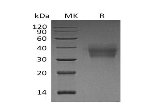 Recombinant Human LMIR2/CD300C Protein (His Tag) - ABMIUM