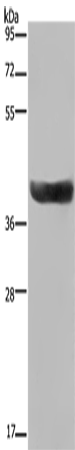 Anti-Human HSD17B2 Antibody - ABMIUM