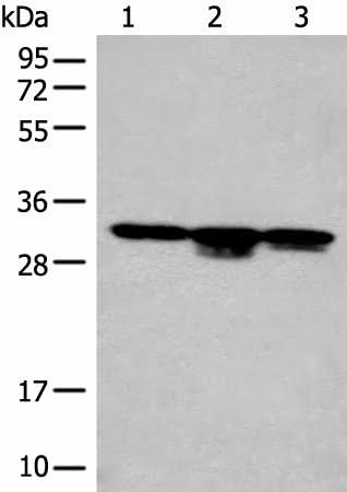 Western blot analysis of RAW264.7 cell Mouse kidney tissue and Mouse heart tissue lysates using CA7 Polyclonal Antibody at dilution of 1:400
