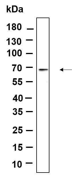 Anti-Human/Mouse/Rat AMPK α1, 2 Antibody [B911] - ABMIUM