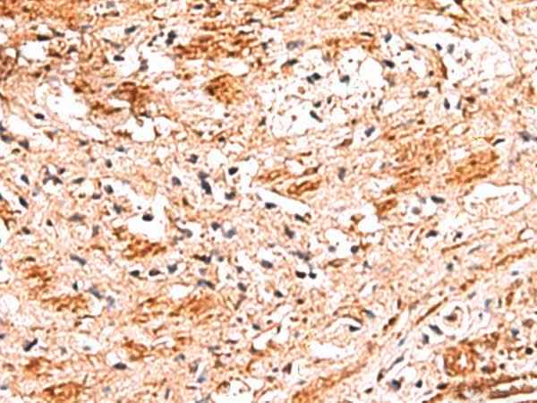 Anti-Human/Mouse NADK Antibody