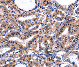 Anti-Human/Mouse FBN1 Antibody - ABMIUM