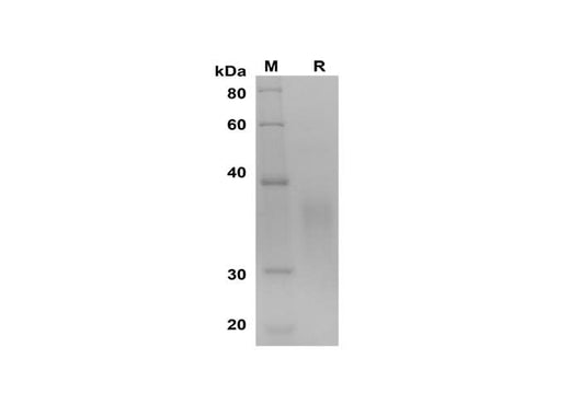SDS-PAGE analysis of Human IL9 proteins, 2 μg/lane of Recombinant Human IL9 proteins was resolved with SDS-PAGE under reducing conditions, showing bands at 30-38 kDa.