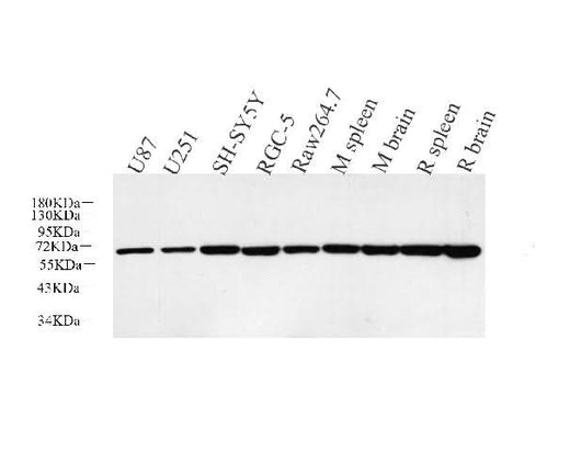 Western Blot analysis of various samples using HSP60 Polyclonal Antibody at dilution of 1:5000.