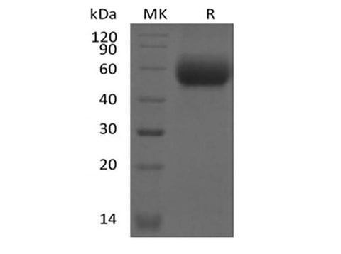 Recombinant Mouse IL-1 Receptor-Like 2/IL-1RL2/IL-1Rrp2/IL-36R (C-6His) - ABMIUM