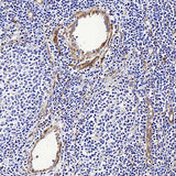 Immunohistochemistry analysis of paraffin-embedded human Lymphoma using LDLR Polyclonal Antibody at dilution of 1:300.