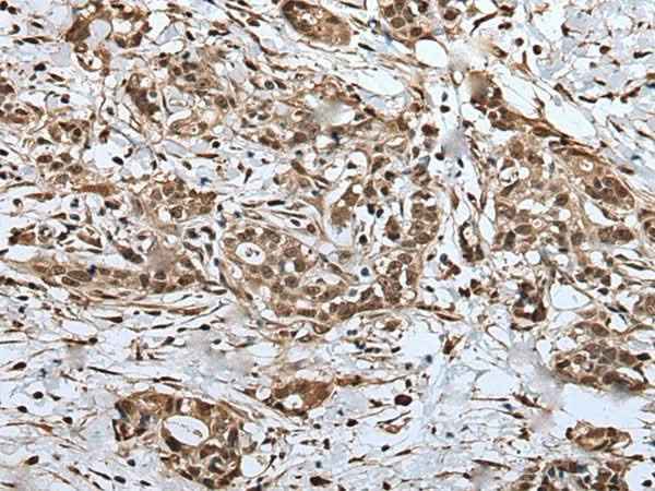 Anti-Human/Mouse UPK3A Antibody