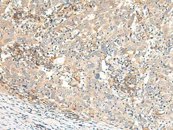 Anti-Human GBP4 Antibody