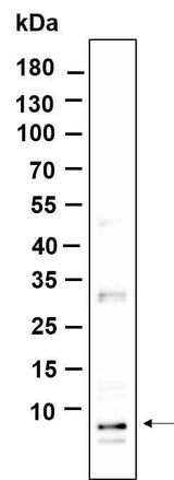 Anti-Human/Mouse/Rat NOP10 Antibody [B991]