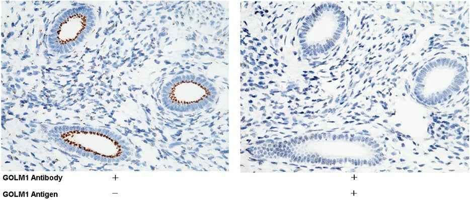 Anti-Human GOLM1 Antibody [B357] - ABMIUM