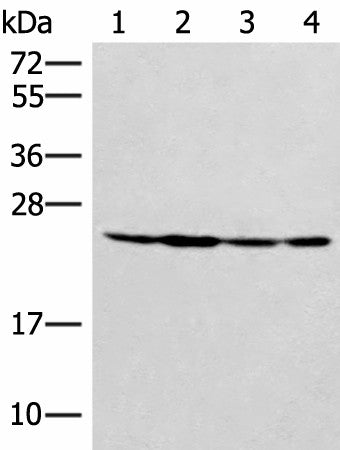 Western blot analysis of Hela 231 and A549 cell Mouse liver tissue lysates using SSSCA1 Polyclonal Antibody at dilution of 1:400