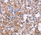 Anti-Human/Mouse DUSP13 Antibody - ABMIUM