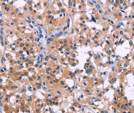 Anti-Human/Mouse DUSP13 Antibody