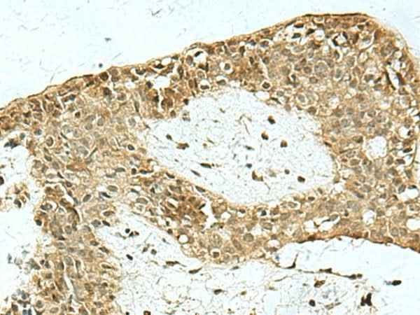 Anti-Human/Mouse/Rat KAT7 Antibody