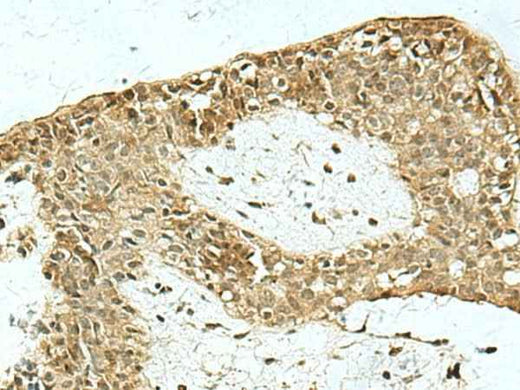 Anti-Human/Mouse/Rat KAT7 Antibody