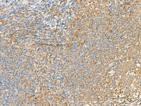 Immunohistochemistry of paraffin-embedded Human tonsil tissue using GRIK2 Polyclonal Antibody at dilution of 1:55(×200)