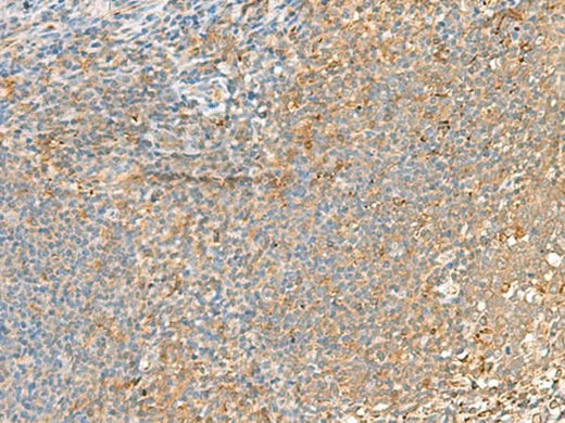 Immunohistochemistry of paraffin-embedded Human tonsil tissue using GRIK2 Polyclonal Antibody at dilution of 1:55(×200)