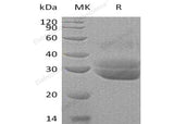 Recombinant Human EPDR1 Protein (His Tag) - ABMIUM