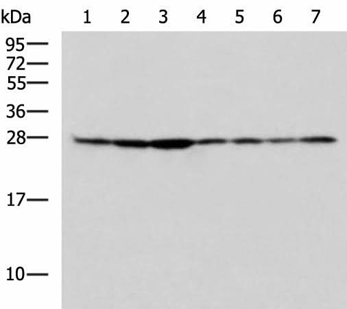 Western blot analysis of HepG2 Hela Jurkat HUVEC cell Mouse lung tissue Mouse kidney tissue Rat liver tissue lysates using RPL10A Polyclonal Antibody at dilution of 1:700