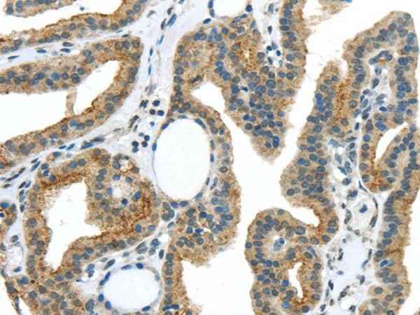 Anti-Human/Mouse/Rat VAMP2 Antibody