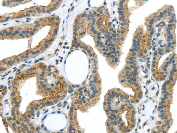 Anti-Human/Mouse/Rat VAMP2 Antibody - ABMIUM