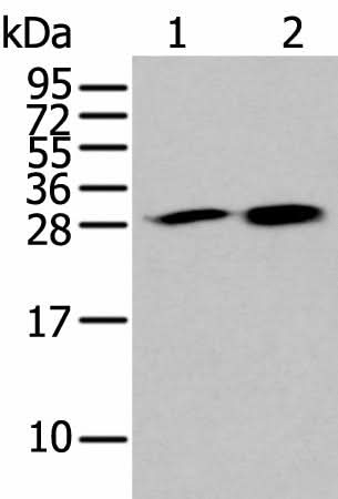 Western blot analysis of 293T and 231 cell lysates using HDHD2 Polyclonal Antibody at dilution of 1:400
