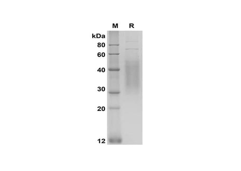 SDS-PAGE analysis of Human IL18BP proteins, 2 μg/lane of Recombinant Human IL18BP proteins was resolved with SDS-PAGE under reducing conditions, showing bands at 30-50 kDa.