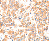 Anti-Human/Mouse/Rat F13A1 Antibody - ABMIUM