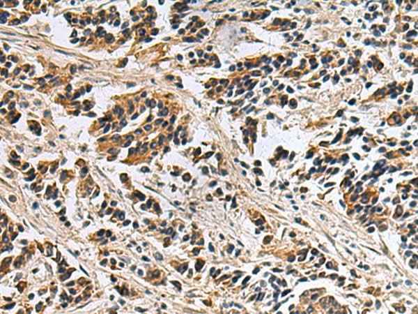 Anti-Human/Mouse DIAPH2 Antibody
