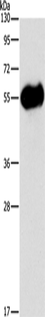 Anti-Human/Mouse AMY2A Antibody - ABMIUM