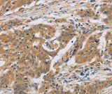 Anti-Human CST6 Antibody - ABMIUM