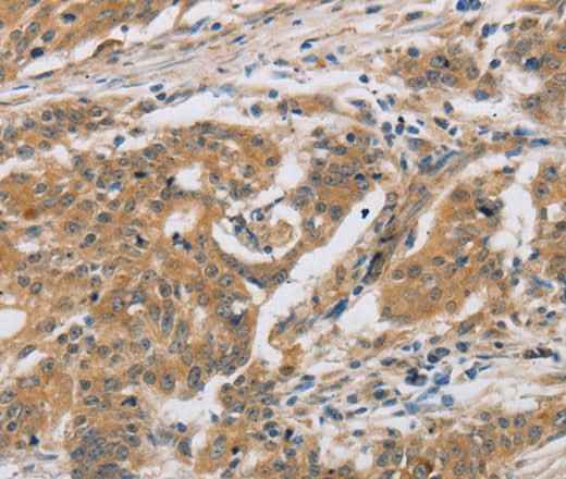 Anti-Human CST6 Antibody