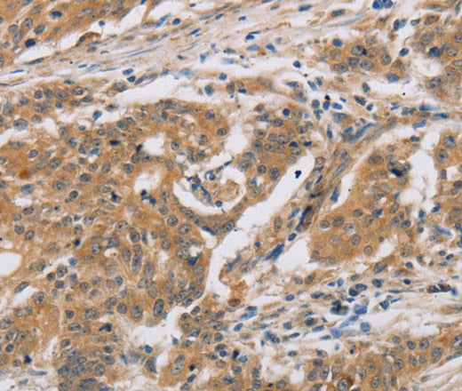 Anti-Human CST6 Antibody - ABMIUM
